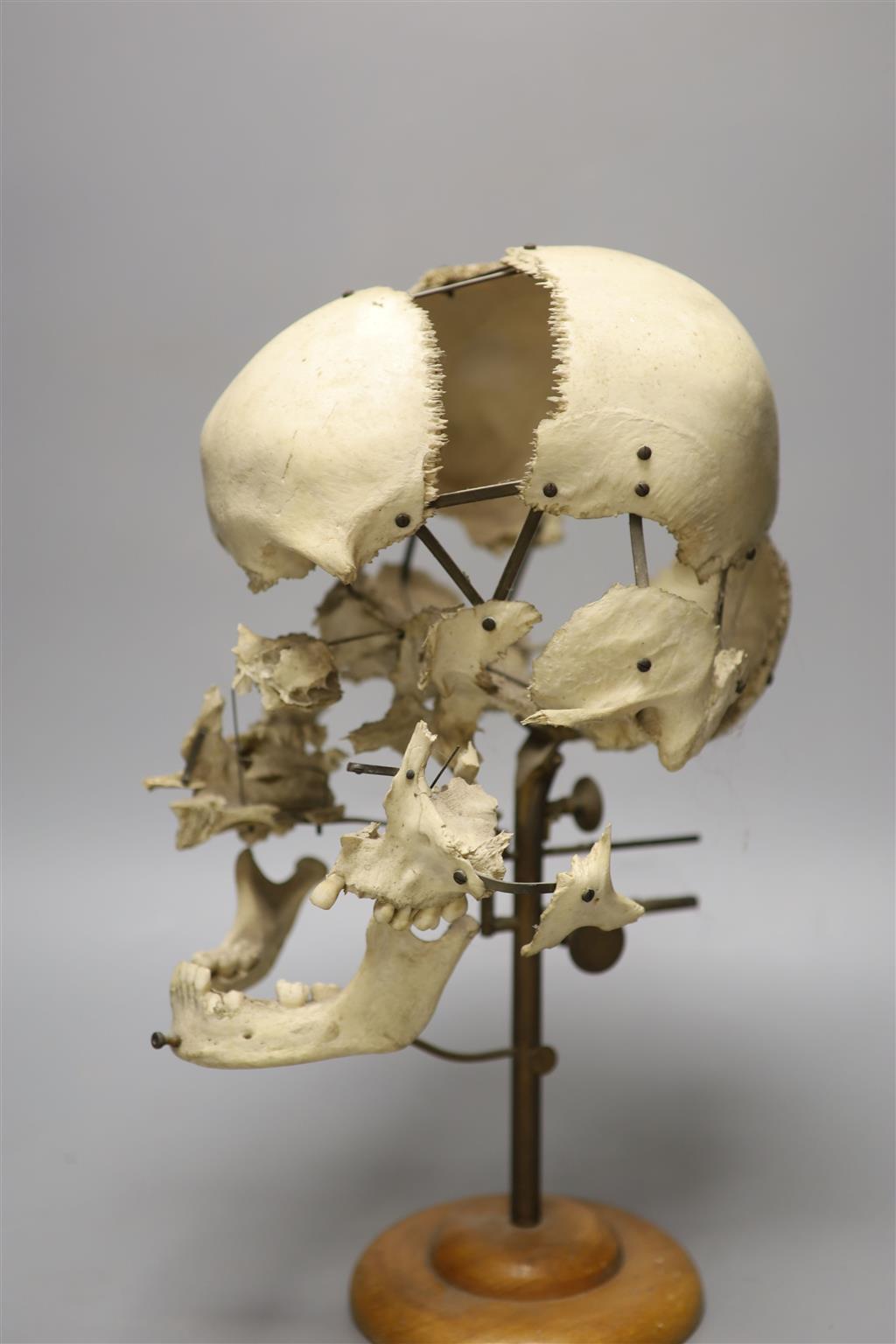 A human skull specimen, 1920s-30s, mounted in exploded form, adjustable brass arms and oak base, 40cm high